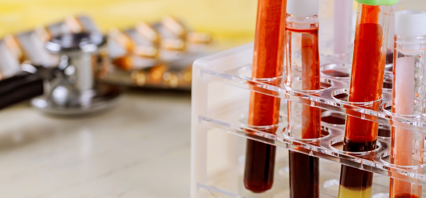 10 Essential General Health Tips